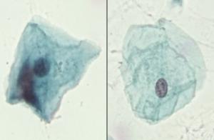 Barr Bodies, Male/Female Comparison Slide