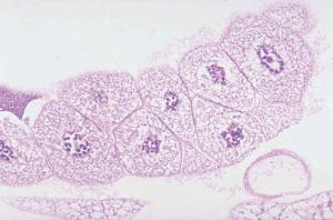 <i>Drosophila</i> Chromosomes Slide