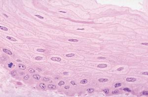 Stratified Squamous Epithelium, Hematoxylin & Eosin