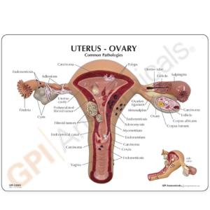 GPI Anatomicals® Basic Uterus Model