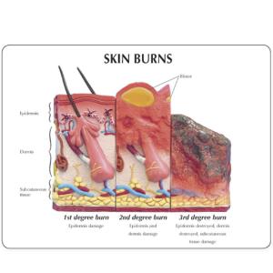 GPI Anatomicals® Skin Health Models