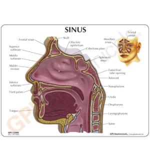 GPI Anatomicals® Basic Sinus Model