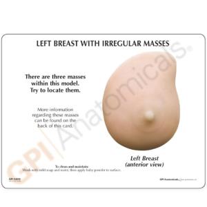 GPI Anatomicals® Left Breast With Irregular Masses Model