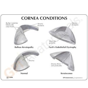 GPI Anatomicals® Cornea Eye Model