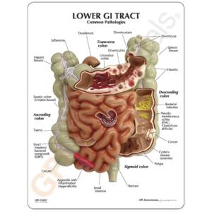 GPI Anatomicals® Gi Tact Model