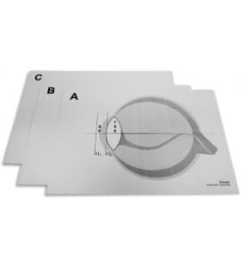 Laser white board optics kit