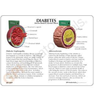 GPI Anatomicals® 4-Piece Diabetes Model