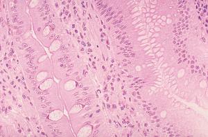 Stomach Slide, Hematoxylin and Eosin