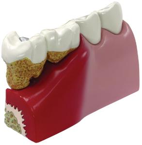 GPI Anatomicals® Basic Teeth Model