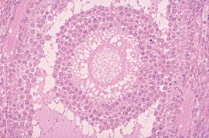 Ovary, Graafian Follicle