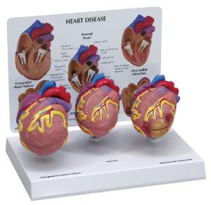 GPI Anatomicals® Heart Disease Model Set