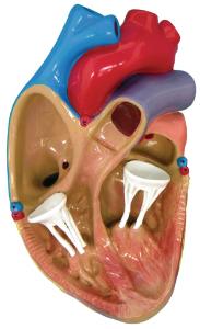 GPI Anatomicals® Heart Disease Model Set