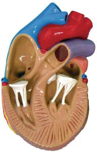 GPI Anatomicals® Heart Disease Model Set