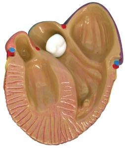 GPI Anatomicals® Heart Disease Model Set