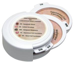 GPI Anatomicals® Skin Cancer Disk Set