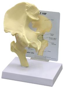 GPI Anatomicals® Basic Hip Model