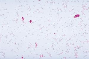 Ward's® Live <i>Klebsiella pneumoniae</i> Culture - PATHOGEN