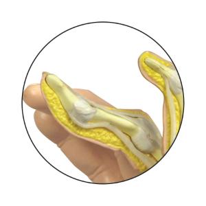 GPI Anatomicals® Rhumatoid Arthritis Hand Model