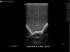 Spinal epidural and lumbar puncture training model