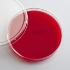 Prepared Blood Agar Media