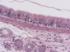 Pseudostratified, Ciliated, Columnar Epithelium, Hematoxylin and Eosin