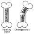 Science Take-Out® Brittle Bones: A Density Problem