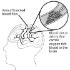 Science Take-Out® Testing A Clot Buster