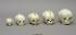 Human Fetal Skulls, Set of 5