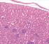 Simple Squamous Epithelium