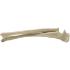 Radius ulna right