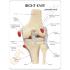 GPI Anatomicals® Basic Knee Model