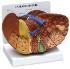 GPI Anatomicals® Liver Pathology Model